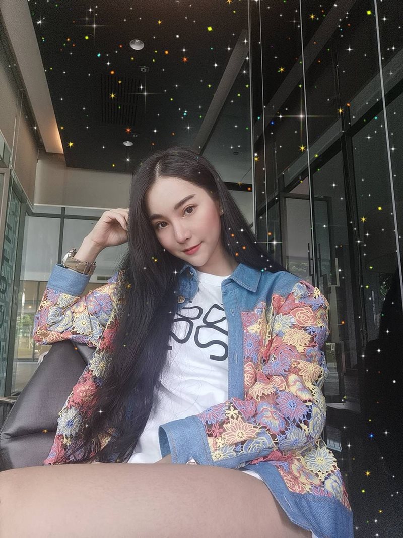 หลังทำตาสองชั้น+เปิดหัวตา 14 วัน ชั้นตาเข้าที่แล้วดูธรรมชาติ