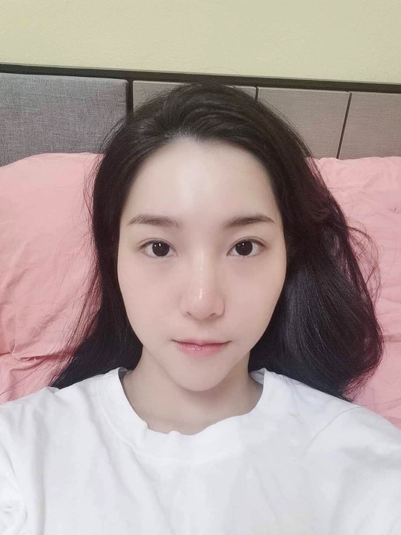 ปัญหาก่อนทำตาสองชั้น ตาเล็ก หนังตาตก หัวตาปิด