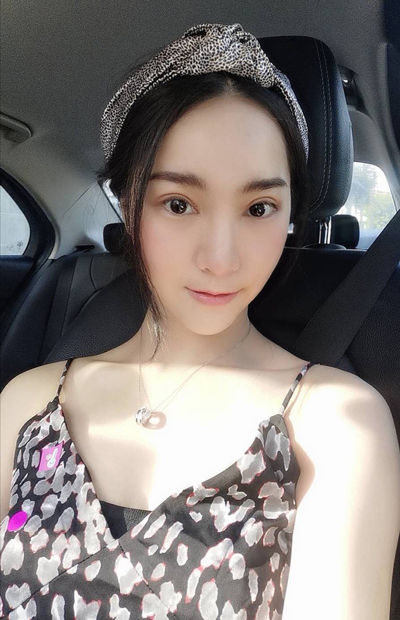 หลังทำตาสองชั้น+เปิดหัวตา 12 วัน ชั้นตาเข้าที่เร็วมาก