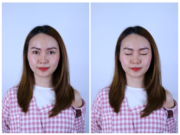หลังศัลยกรรมตาสองชั้น+เปิดหัวตา 4 เดือน ชั้นตาดูเป็นธรรมชาติ