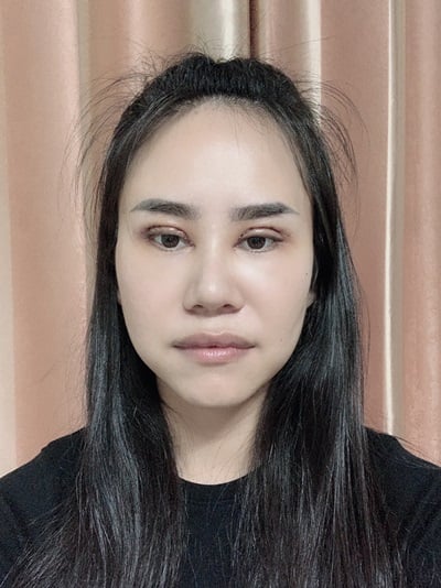 ทำตาสองชั้น เปิดหัวตา 7 (6).jpg