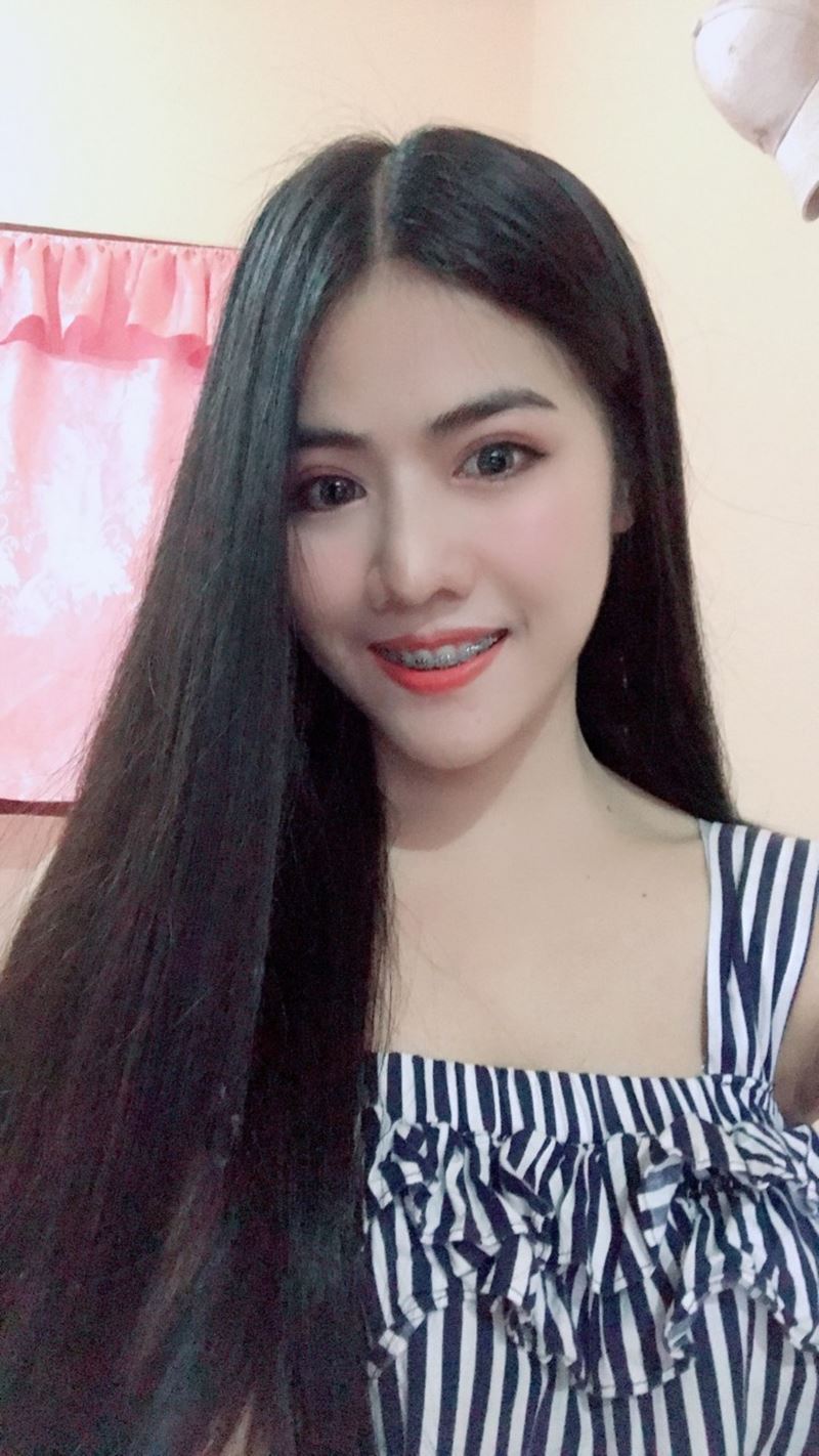 หลังทำตาสองชั้น + เปิดหัวตา 1 เดือน ตาดูกลมโต สดใส แต่งหน้าได้เต็มที่
