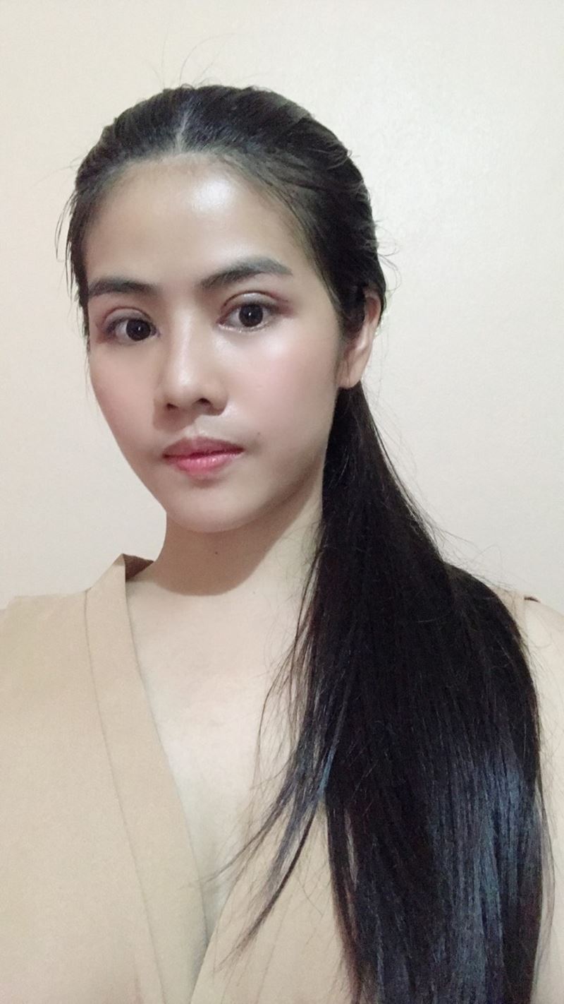 หลังทำตาสองชั้น + เปิดหัวตา 10 วัน ตาโตและตาหวานขึ้น