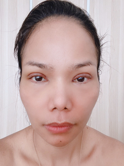 ทำตาสองชั้น 01 (9).jpg
