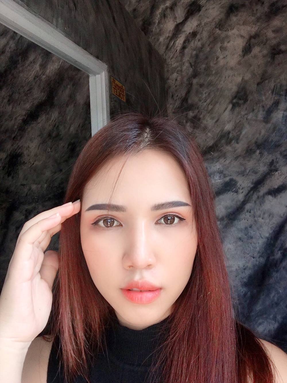 หลังทำตาสองชั้น+เปิดหัวตา 2 เดือน