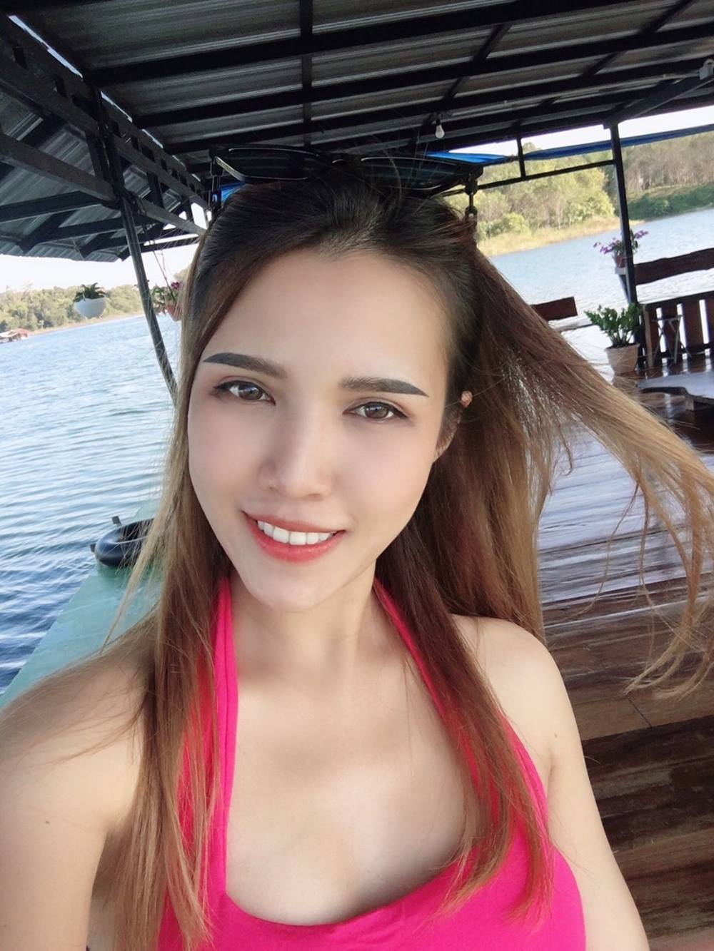 หลังทำตาสองชั้น+เปิดหัวตา 1 เดือน