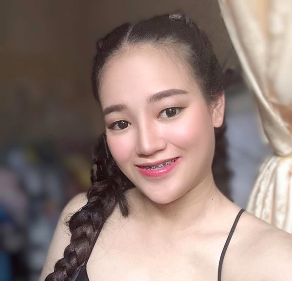 ก่อนทำตาสองชั้น หนังตาตก ชั้นตาหลบใน จากหนังตากับไขมันตาส่วนเกินที่สะสมอยู่เยอะ