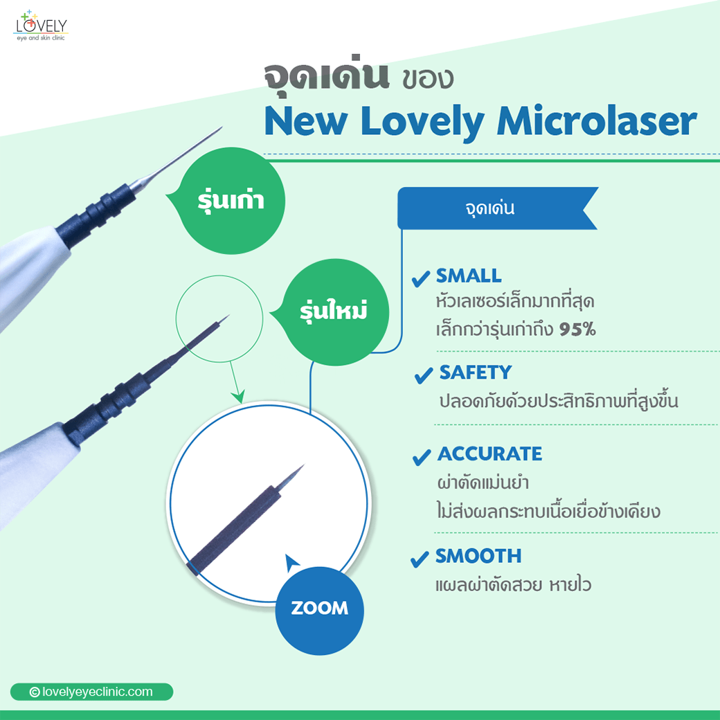 จุดเด่นของเลเซอร์ตาสองชั้น New Lovely Microlaser