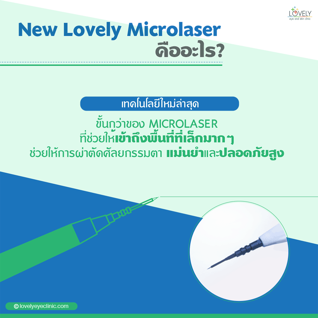 New Lovely Microlaser เทคโนโลยีเลเซอร์ตาสองชั้นใหม่ล่าสุด
