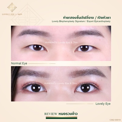 ทำตาสองชั้นเทคนิคหมอรวงข้าว 1 (1).jpg