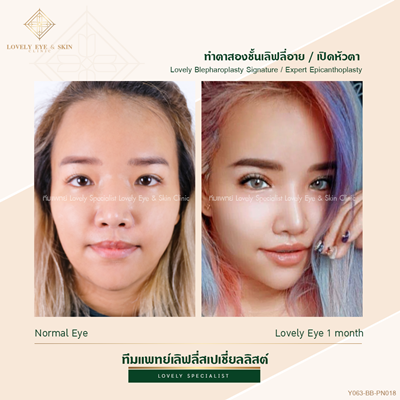 ทำตาสองชั้นเทคนิคหมอรวงข้าว 1 (1).png