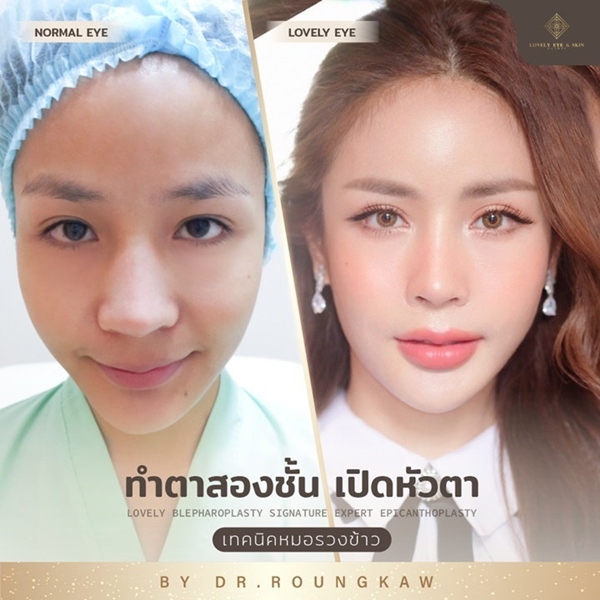 เปิดหัวตา
