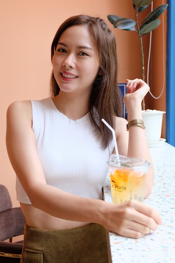 หลังทําตาสองชั้น+เปิดหัวตา 8 ปีแล้ว ไม่มีรอยจากการผ่าตัดให้เห็นเลย