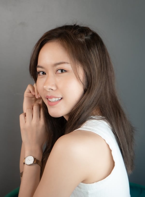 หลังทําตาสองชั้น+เปิดหัวตา 8 ปี คุณหมอแนะนำดี บริการดี