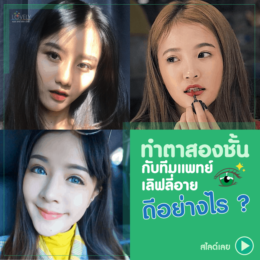 ทําตาสองชั้นกับทีมแพทย์เลิฟลี่อาย ดีอย่างไร-1 IG (1).png