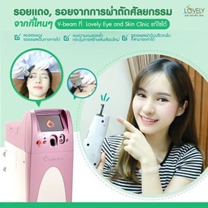 ผิวแตกลาย6.jpg