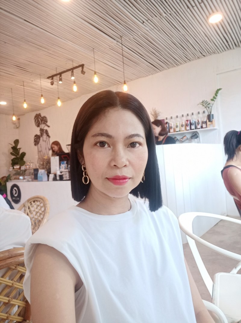 หลังยกหางตาซ่อนแผลใต้คิ้ว 1 เดือน แก้หางตาตก