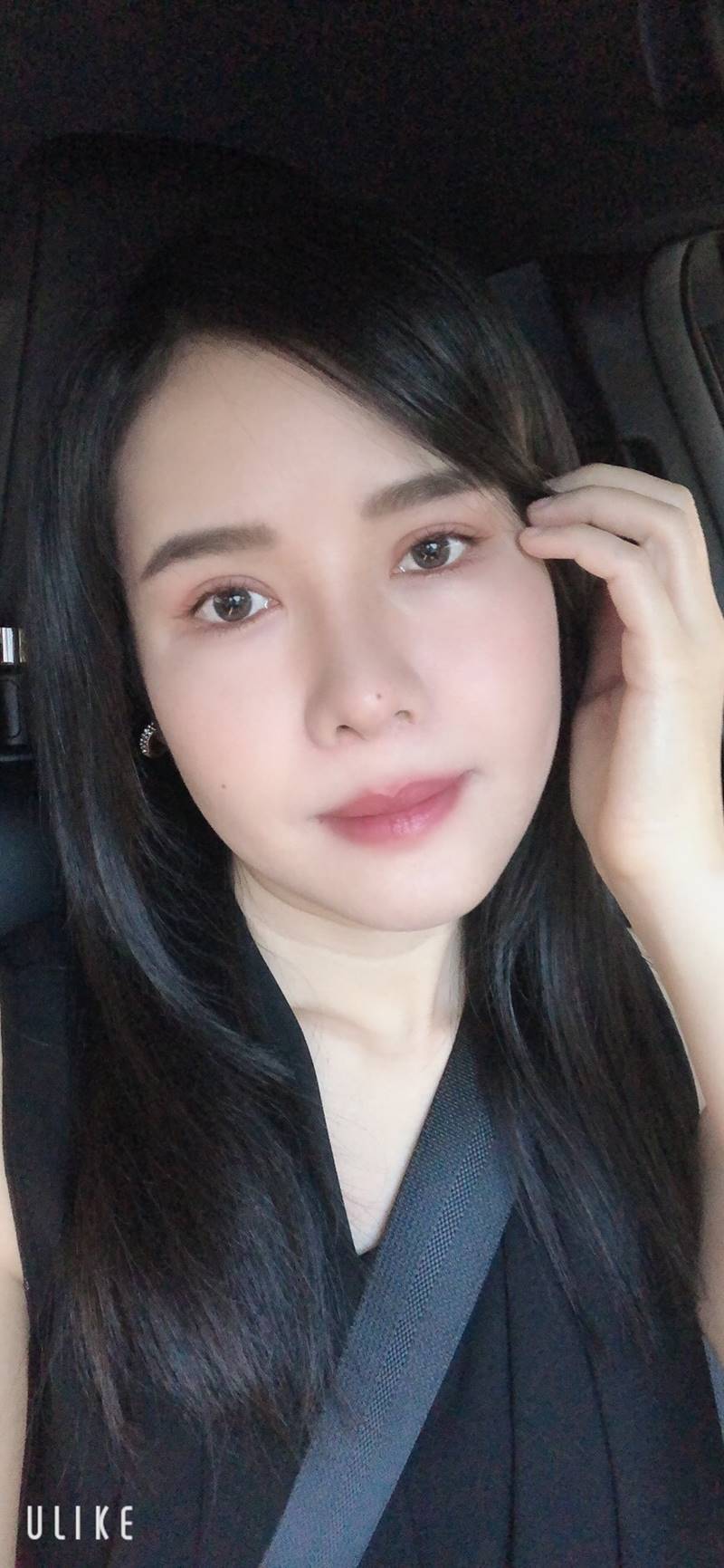 ยกหางตาซ่อนแผลใต้คิ้ว 20 (6).jpg