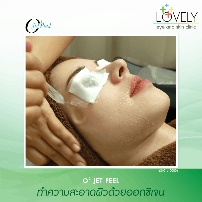 รักษารอยสิว 5_0.png