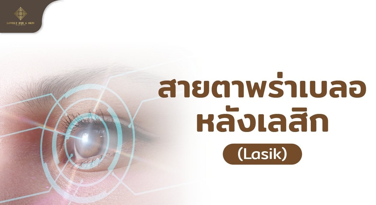 สายตาพร่าเบลอหลังเลสิก