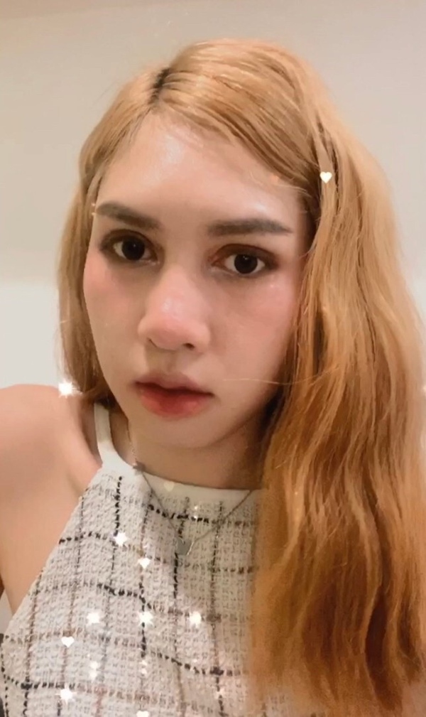 ศัลยกรรมตาสองชั้น (1)_0.jpg