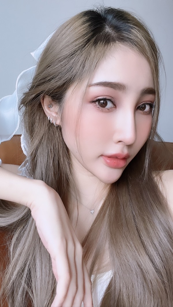 หลังศัลยกรรมตาสองชั้น+เปิดหัวตา+ดึงกล้ามเนื้อตา+เติมไขมัน 1 เดือน 10 วัน รู้สึกสดใส ตาโตมาก