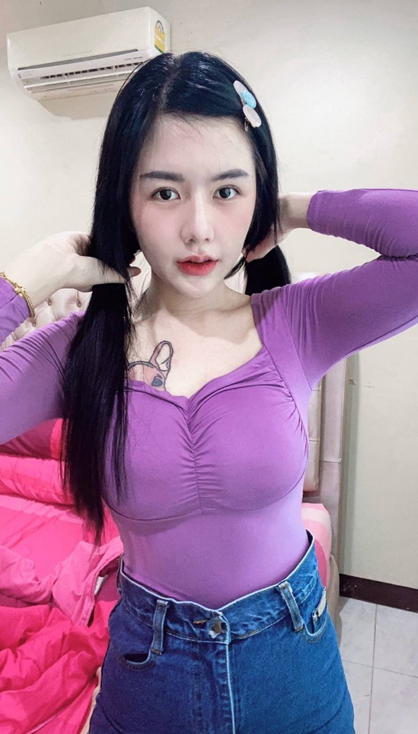 หลังศัลยกรรมตาสองชั้น 4 เดือน ชั้นตาที่ชัดเจนขึ้นแล้ว ช่วยแก้ปัญหาหนังตาตก 