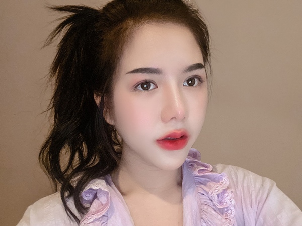 ศัลยกรรมตาสองชั้น คุณหมอกับพนักงานทุกคนดูแลใส่ใจดีมาก