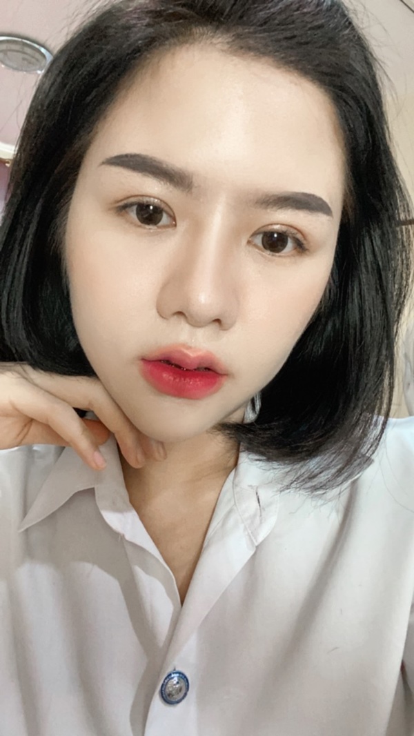 หลังศัลยกรรมตาสองชั้น ชั้นตาออกมาได้เข้ากับหน้าและรูปทรงดวงตาของเรา ดูธรรมชาติ