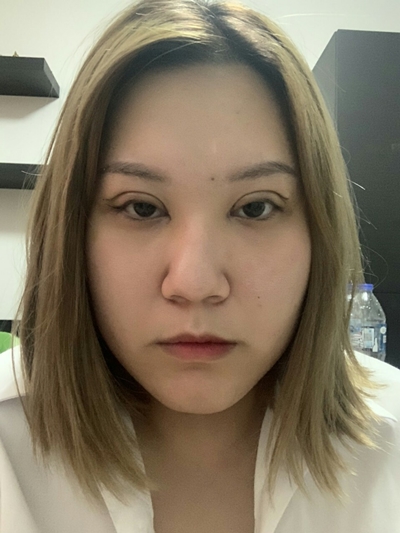 ทำตาสองชั้น เปิดหัวตา ขนตาทิ่มตา