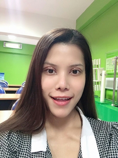 ทำตาสองชั้น เปิดหัวตา หนังตาตก