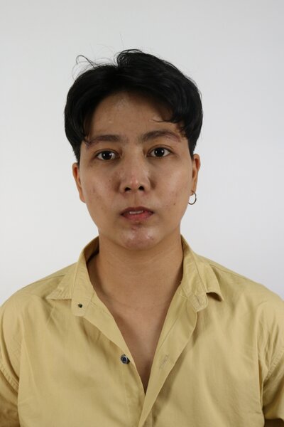 ยกหางตาซ่อนแผลใต้คิ้ว หางตาตก ยกใต้คิ้ว