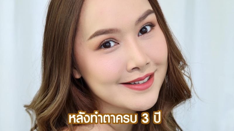 หลังทำตาสองชั้น 3 ปี แฮปปี้มาก แต่งหน้าเบาๆ ก็ดูสวย
