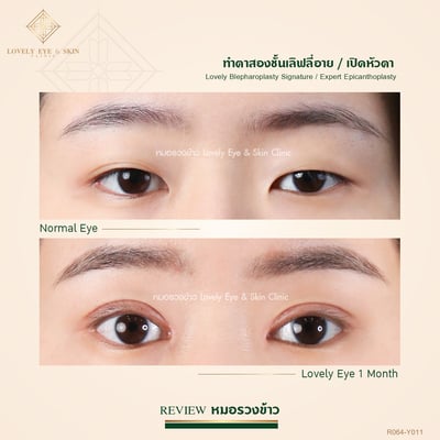 เปิดหัวตา เทคนิคหมอรวงข้าว (2).jpg