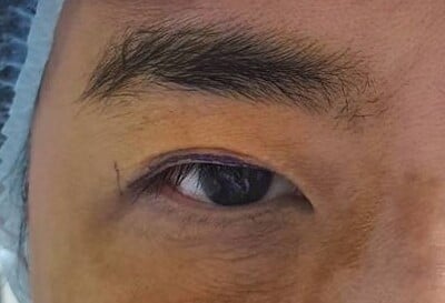 เปิดหัวตา เทคนิคหมอรวงข้าว (4)_0.jpg
