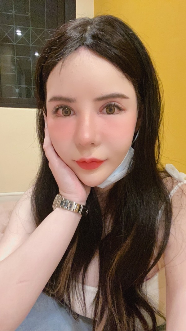 หลังเปิดหัวตา+เปิดหางตา 7 วัน แผลเนียน ตาดูเปลี่ยนไป ดูสวยขึ้น