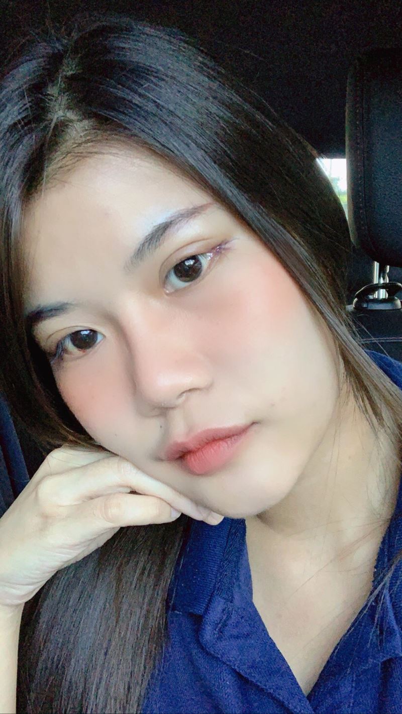 หลังเปิดหางตา 3 วัน ตาเรียวขึ้นและกว้างขึ้น