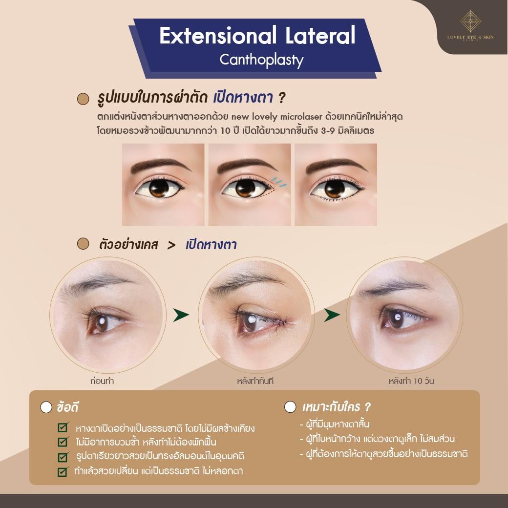 เปิดหางตา เทคนิคหมอรวงข้าว เพิ่มความยาวหางตาได้มากถึง 3-9 มิลลิเมตร