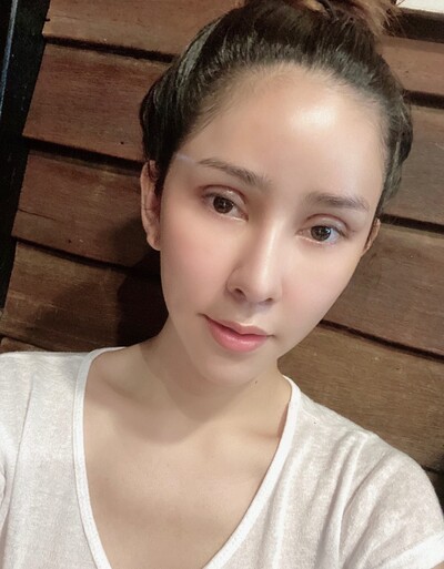 แก้ตาสองชั้น เทคนิคหมอรวงข้าว 2 (2).jpg