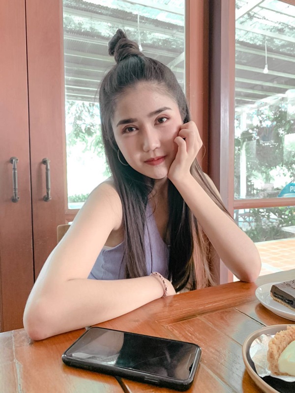 หลังแก้ตาสองชั้น+เปิดหัวตา 2 เดือน มั่นใจเวลาแต่งหน้าแต่งตัวมากขึ้น