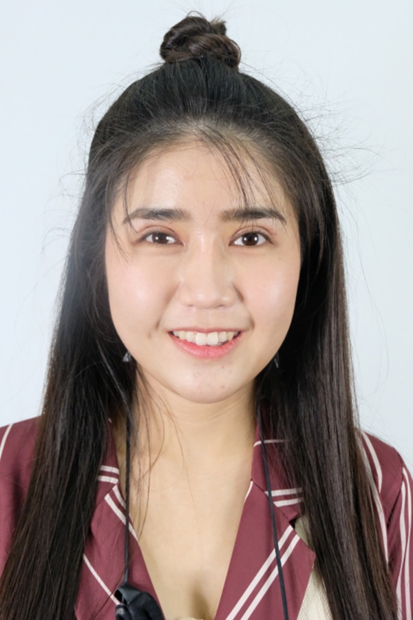 หลังแก้ตาสองชั้น+เปิดหัวตา 1 เดือน ชั้นตาคมชัดเจน ชั้นตาดูเท่ากัน