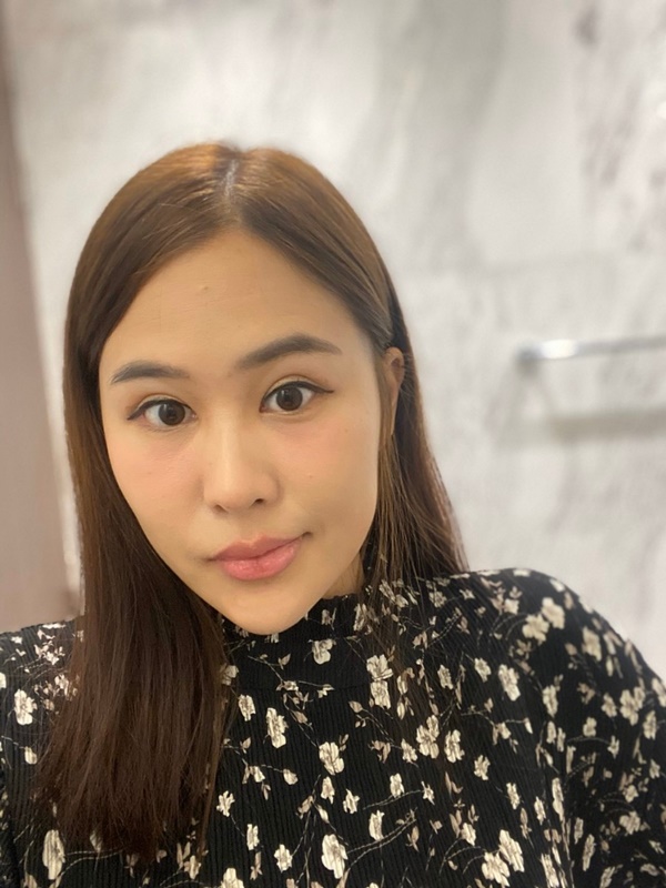 แก้ตาสองชั้น เปิดหัวตา 26_6_23 (5).jpg