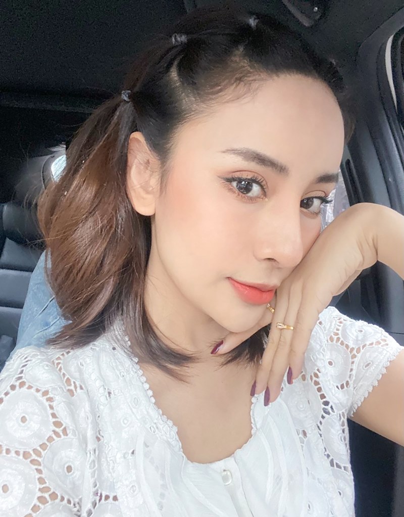 หลังแก้ตาสองชั้น เปิดหัวตา 1 เดือน