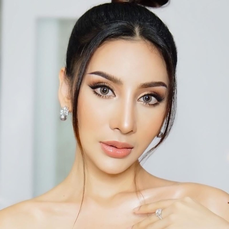หลังแก้ตาสองชั้น เปิดหัวตา ชั้นตาชัดเจน