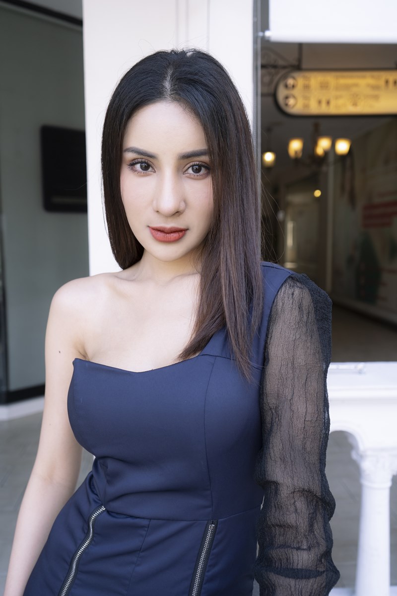 หลังแก้ตาสองชั้น+เปิดหัวตา 3 เดือน ตาสวย มั่นใจขึ้น