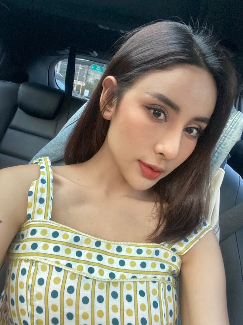 หลังแก้ตาสองชั้น เปิดหัวตา 1 เดือน ตาไม่ปรือ ดูสดใส