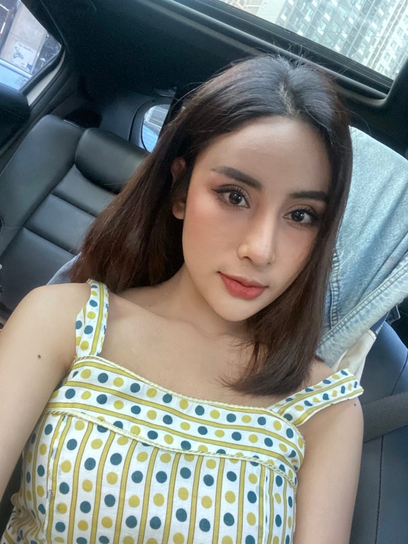 หลังแก้ตาสองชั้น เปิดหัวตา 1 เดือน ได้ลุคใหม่