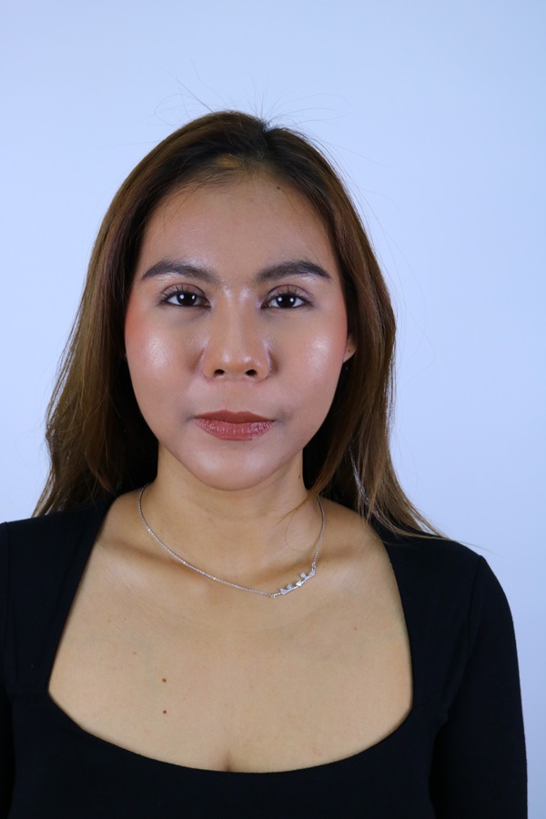 หลังแก้ตาสองชั้น+เปิดหัวตา 1 เดือน ชั้นตาเข้าที่ ดูธรรมชาติ