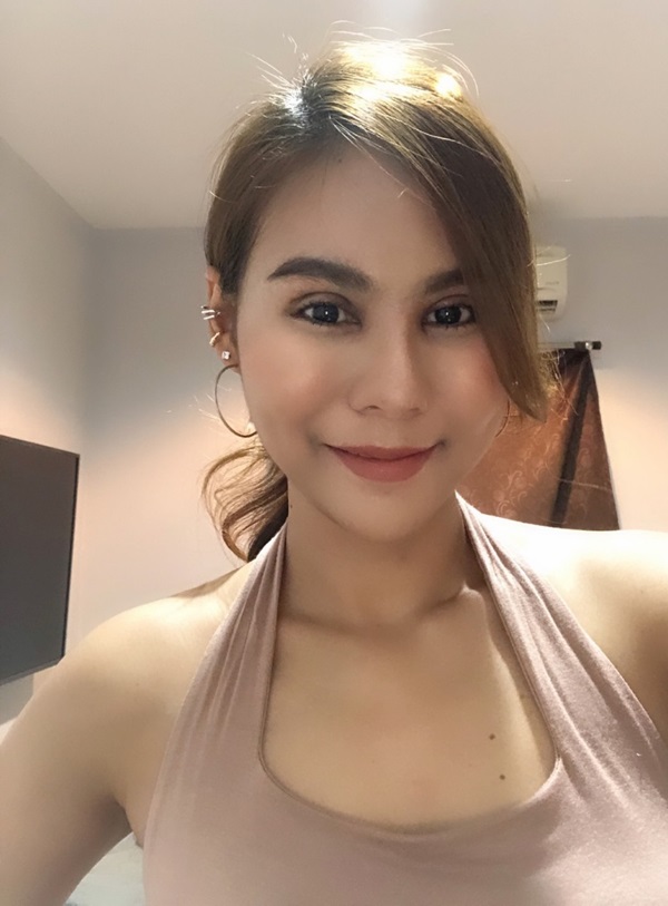 หลังแก้ตาสองชั้น+เปิดหัวตา 16 วัน ชั้นตาและรูปทรงตาสวยมากๆ