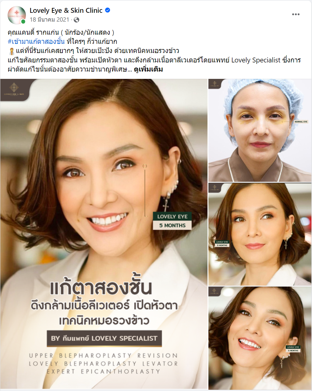 แคนดี้ ราก.png